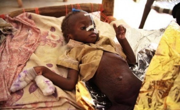 FAO: número de pessoas com fome se reduziu a 868 milhões no mundo